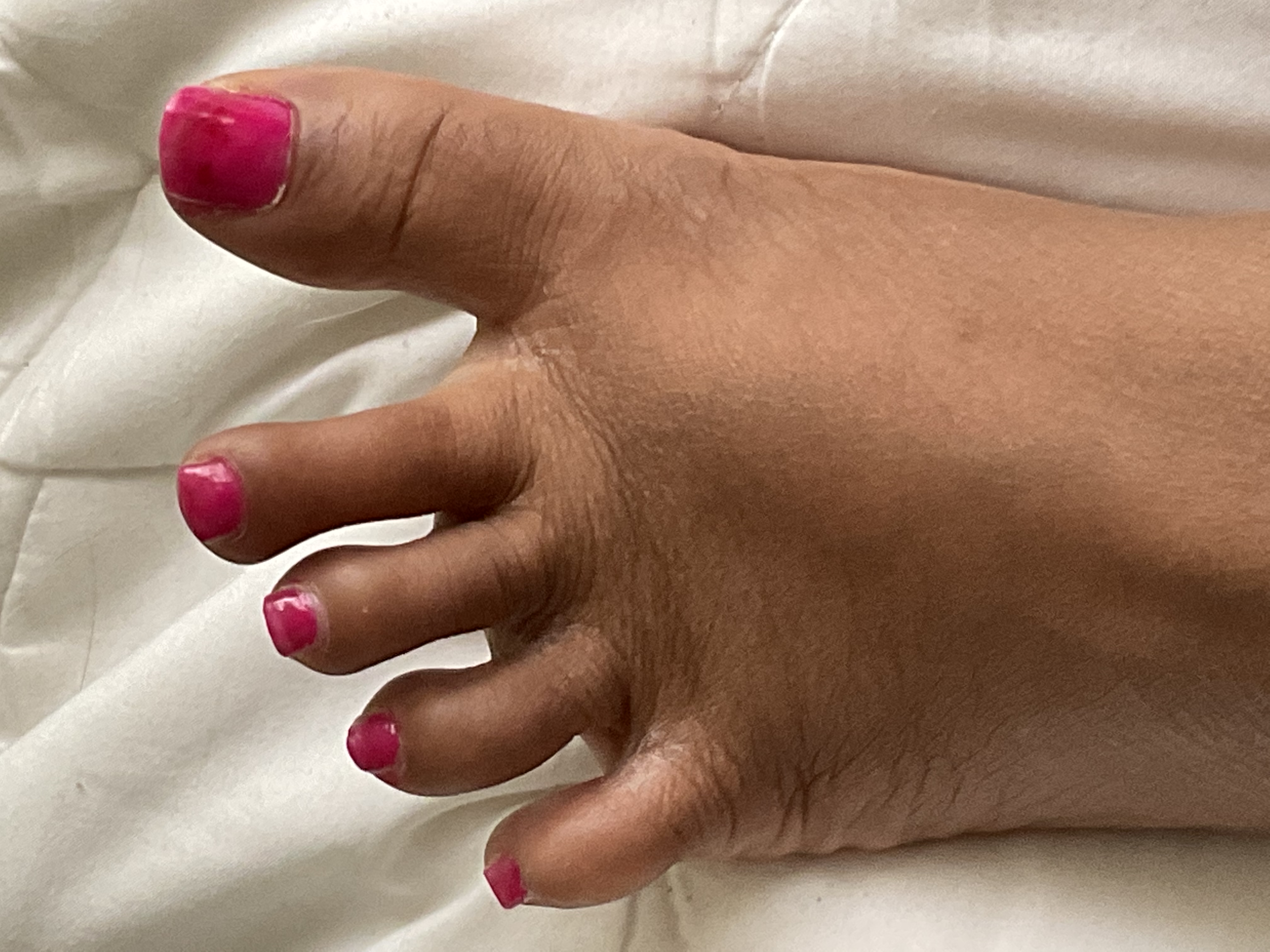 What Does A Pink Toe Mean At Laverne Haskins Blog